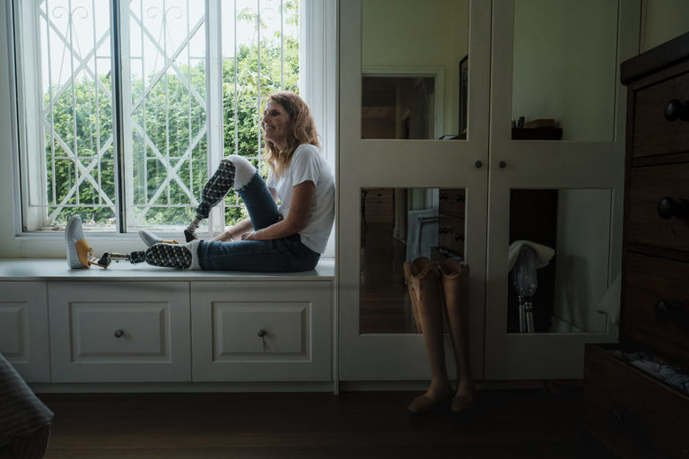 Portrait of a young woman sitting in a window seat in a bedroom. She has one leg straight, the other bent. She is wearing 2 prosthetic legs from the knee down